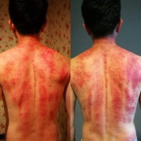 IMG_20170605_193646 竹北-鄉親養生館 按摩外還有滷肉飯吃